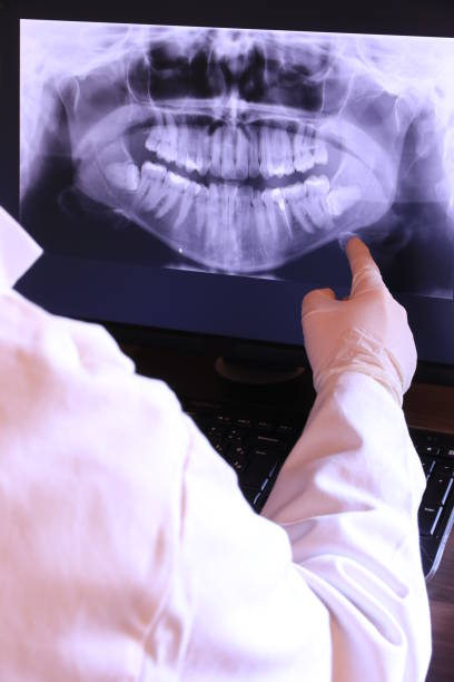 Best Emergency Tooth Extraction  in Rio Del Mar, CA