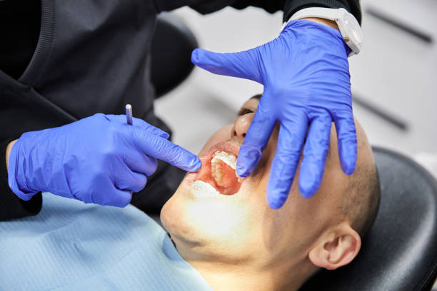 Best Knocked-Out Tooth Emergency  in Rio Del Mar, CA